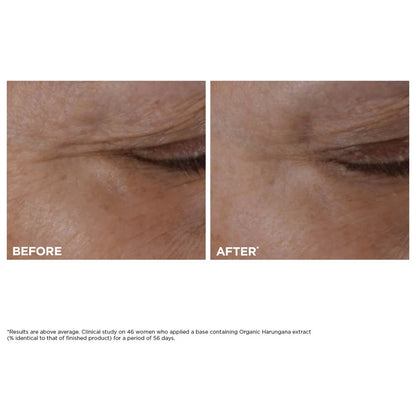 Total Eye Lift Refillable Eye Cream for Firming, Wrinkles, Dark Circles + Puffiness