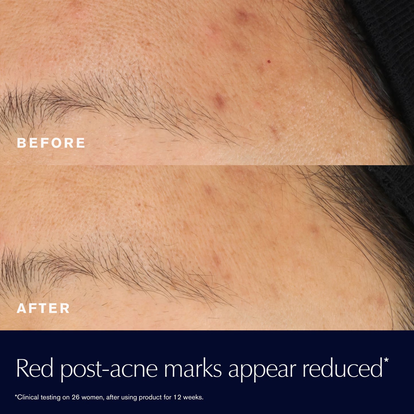 Advanced Night Repair Rescue Solution Serum with 15% Bifidus Ferment