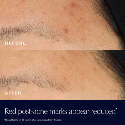 Advanced Night Repair Rescue Solution Serum with 15% Bifidus Ferment