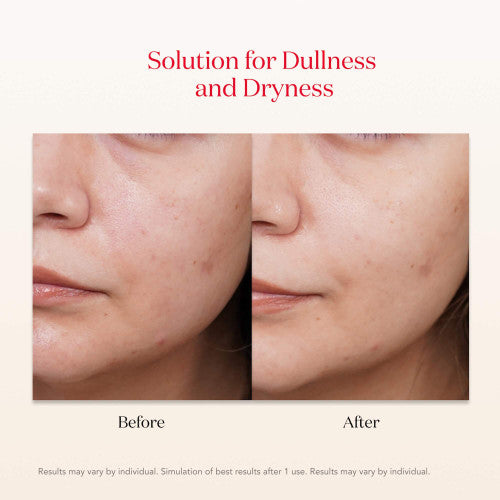 PITERA™ Facial Treatment Mask