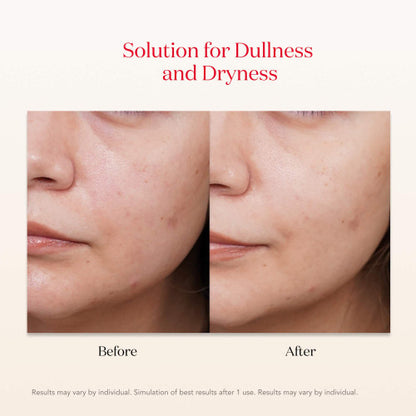 PITERA™ Facial Treatment Mask